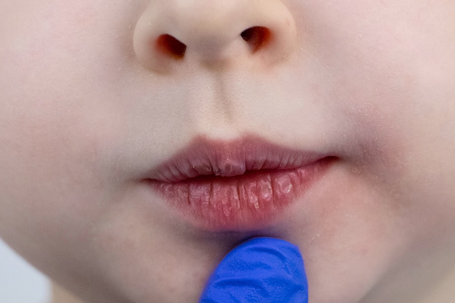 Lips photo