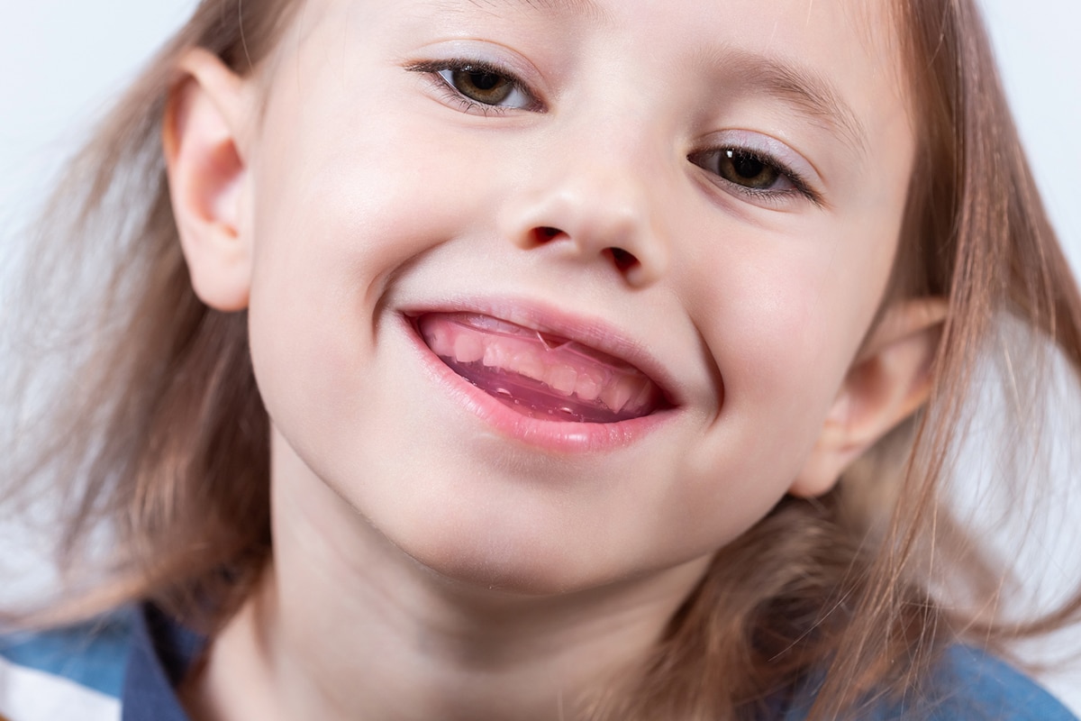 Why early intervention in myofunctional therapy is key for kids blog